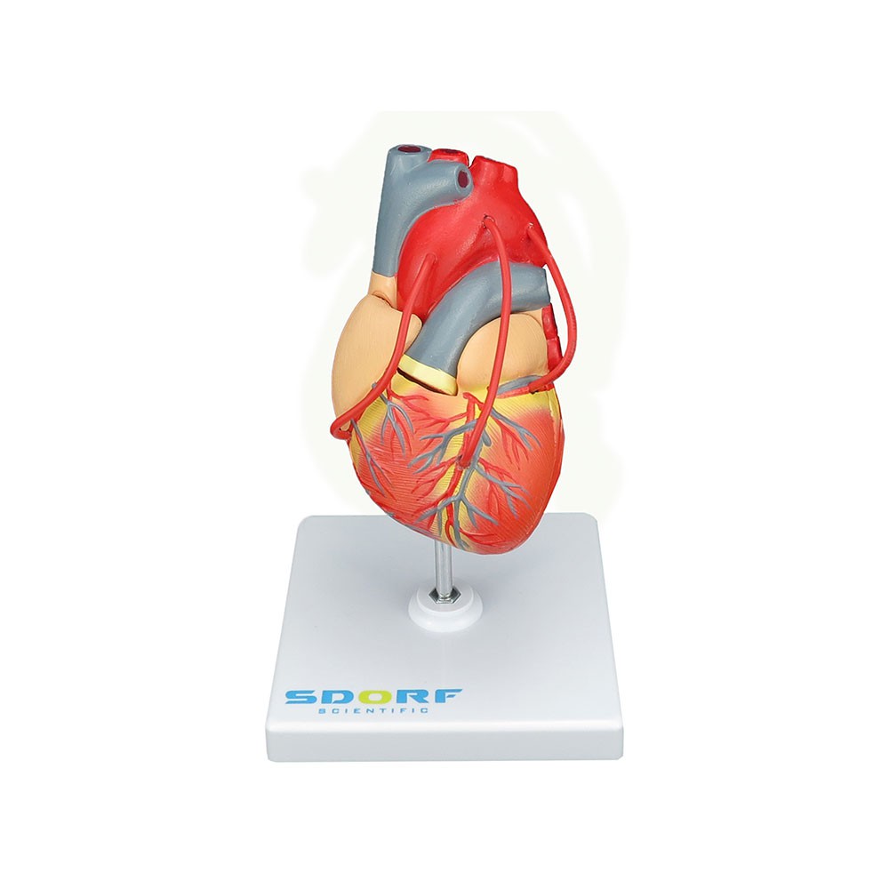Modelo Patológico Do Coração Com Potagem Coronária Sd-5215 Sdorf