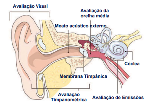 ALUGUEL DE  EQUIPAMENTO DE EMISSÕES OTO-ACÚSTICAS SCREENER - OTO-SONIC saúde auditiva e do sono