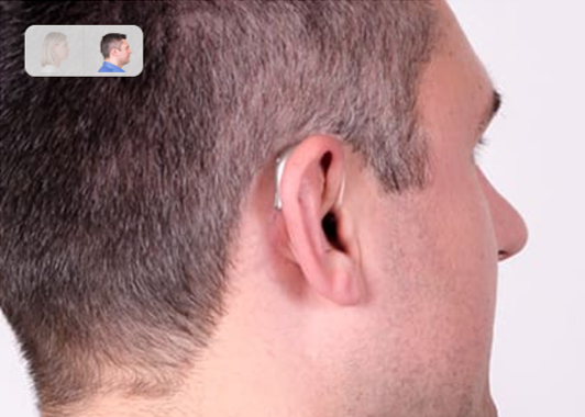 aparelho auditivo recarregável linha Viron Bernafon com Bluetooth  - OTO-SONIC saúde auditiva e do sono