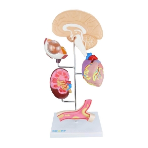Modelo de Órgãos Afetados Pela Hipertensão em 8 Partes - Sdorf - SD-5212