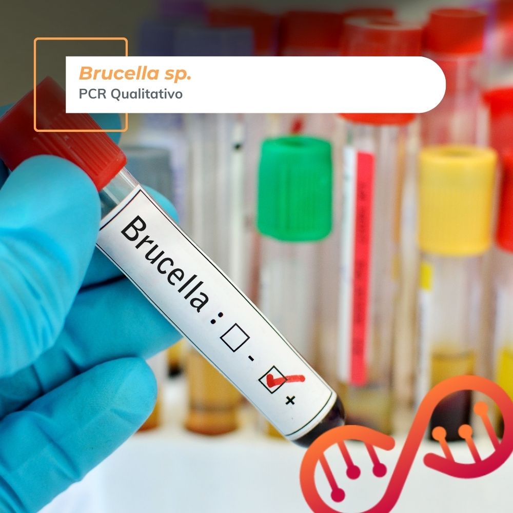 Brucella spp., PCR Qualitativo