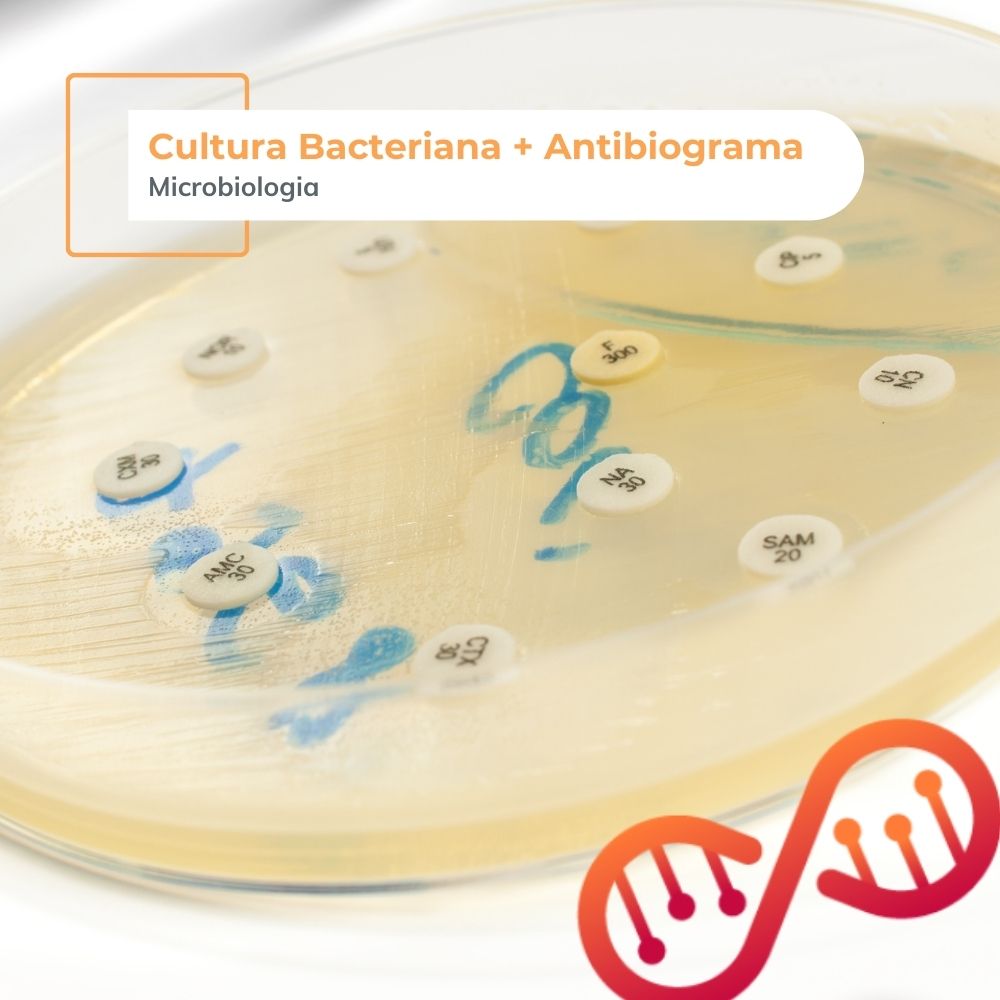 Cultura Bacteriana + Antibiograma
