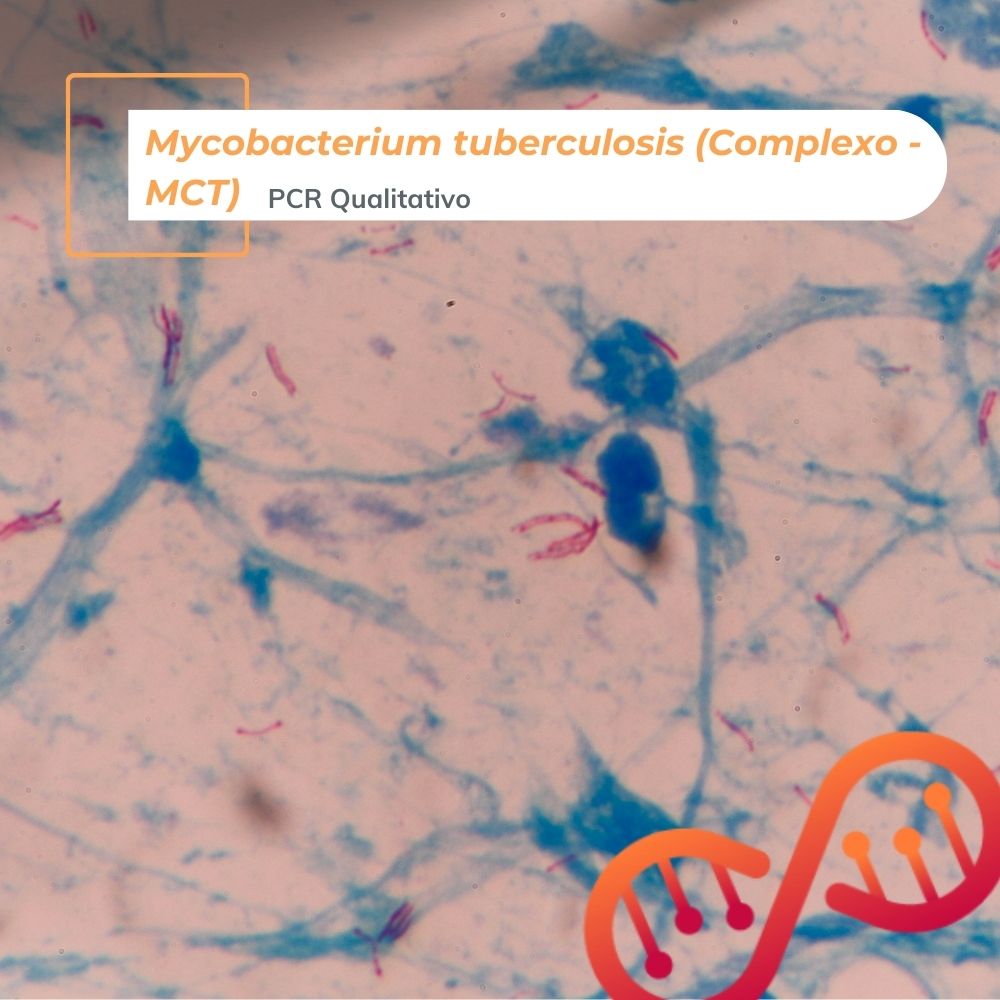 Mycobacterium tuberculosis (Complexo MCT), PCR Qualitativo