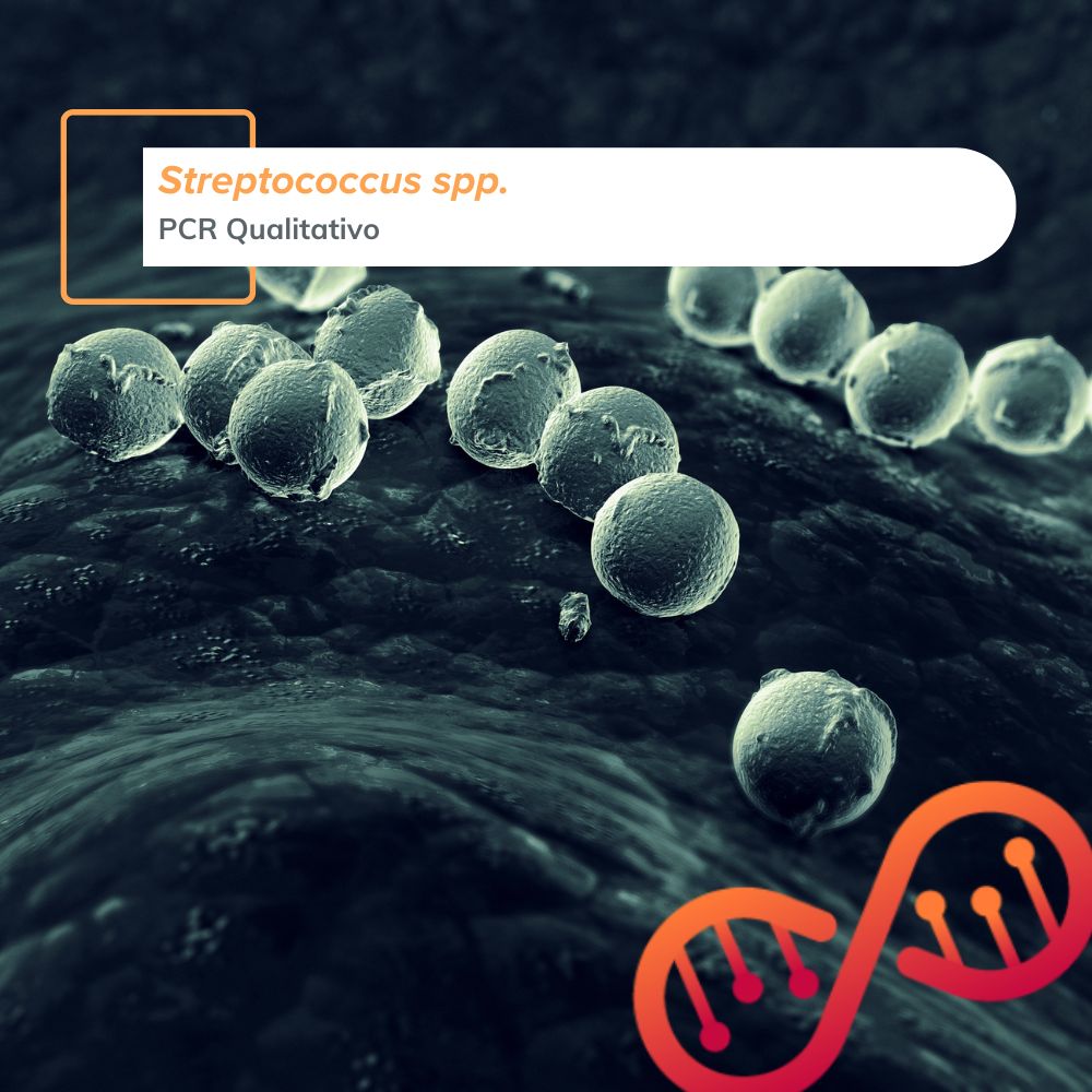 Streptococcus spp., PCR Qualitativo