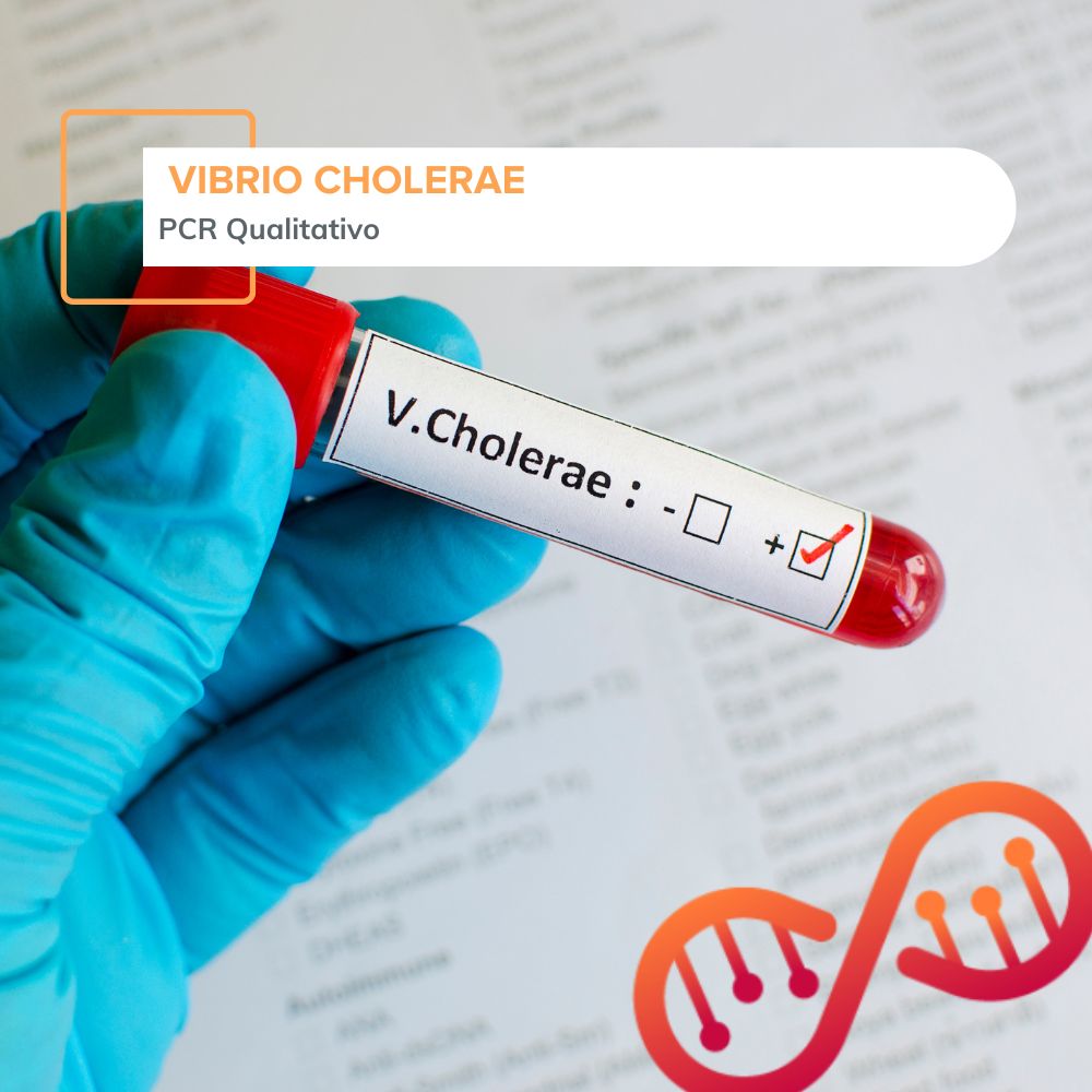 Vibrio cholerae, PCR Qualitativo