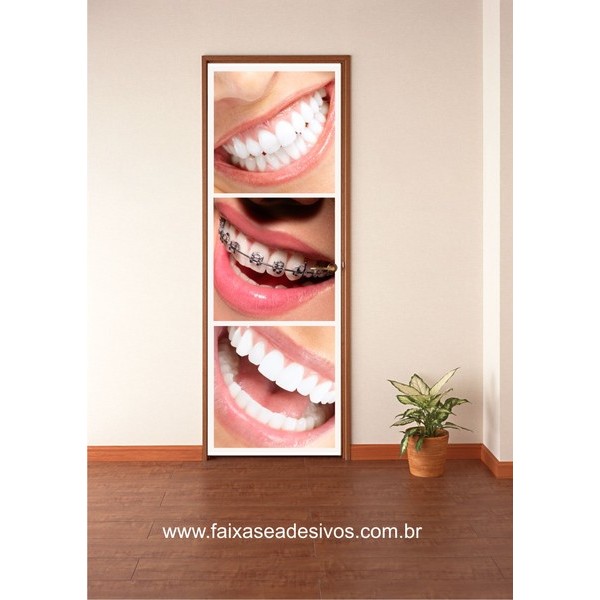 Dentista sorriso bonito adesivo 220x80cm - Fac Signs