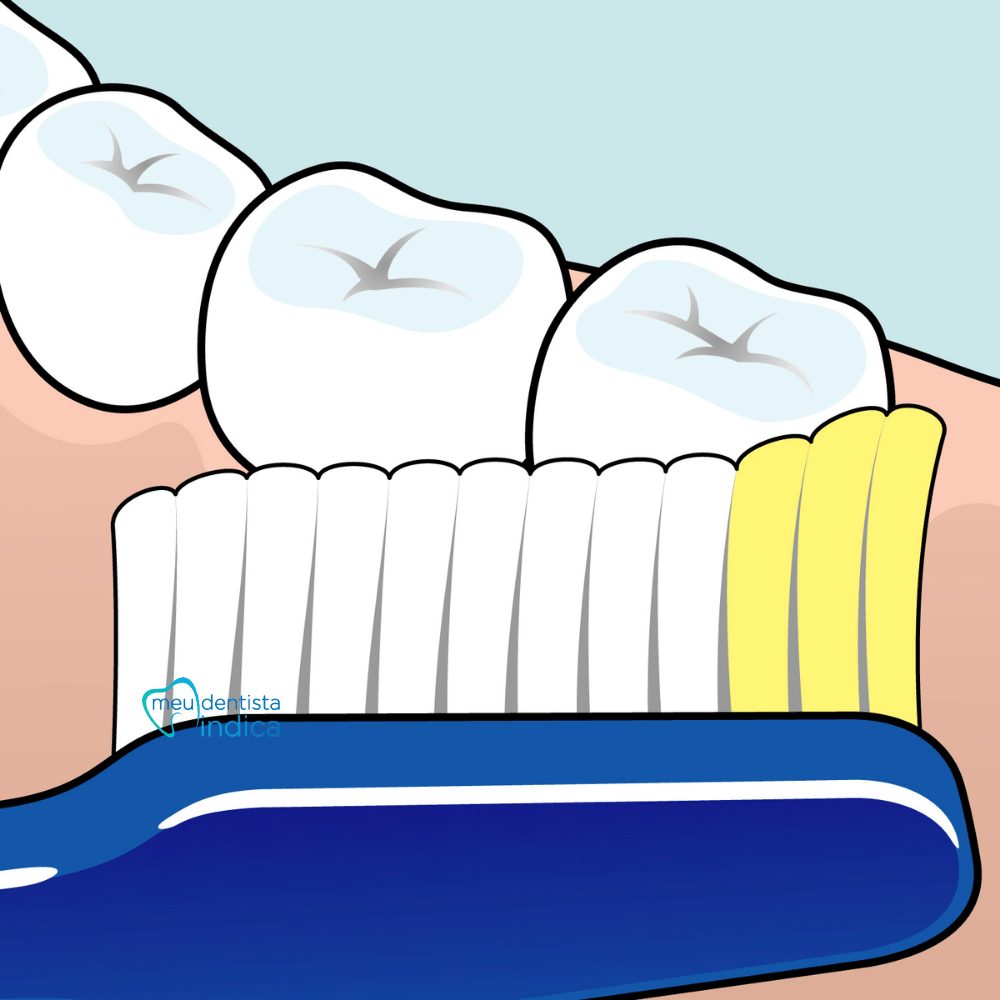 Escova Dental TePe | NOVA Soft | 1 unidade