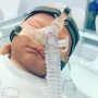 Respireo SOFT Baby Nasal Pediátrica - Air Liquide