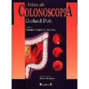 Atlas de Colonoscopia 