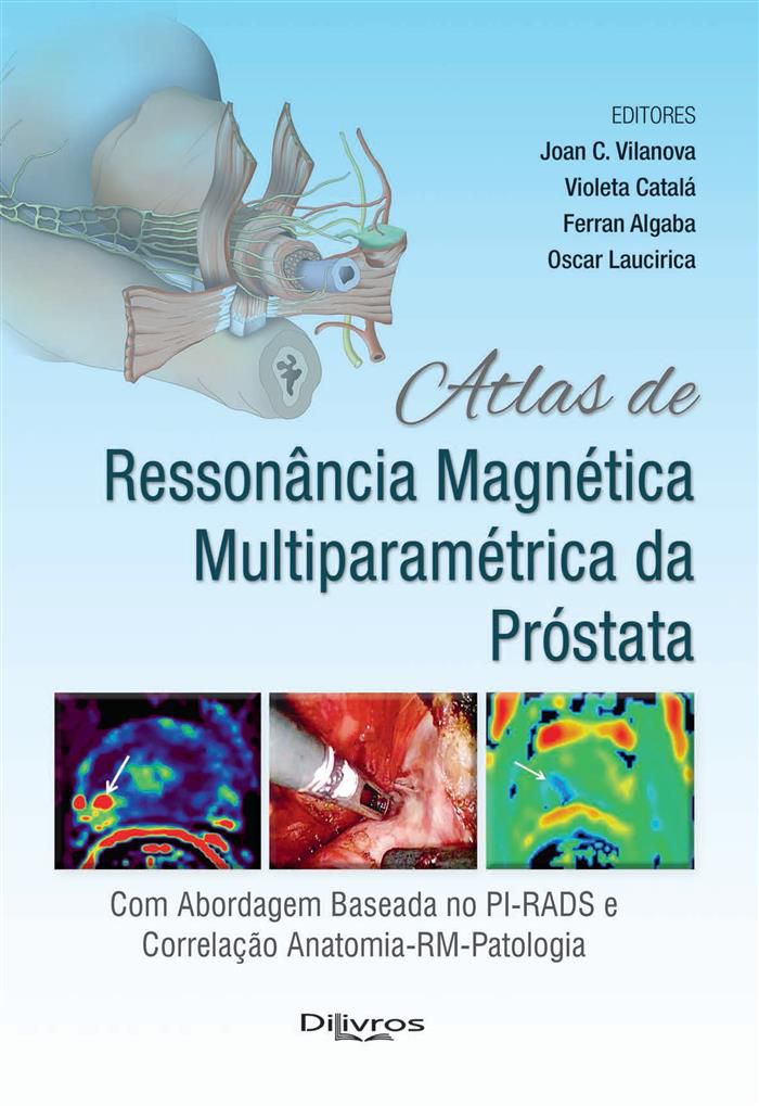 ATLAS DE RESSONANCIA MAGNETICA MULTIPARAMETRICA DA PROSTATA