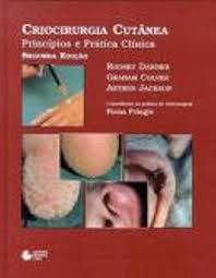 Criocirurgia cutânea princípios e prática clínica