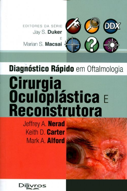 CIRURGIA OCULOPLASTICA E RECONSTRUTORA
