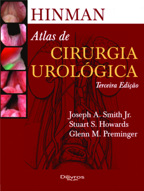 livro - Hinman - Atlas de Cirurgia Urológica