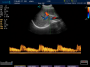 Aparelho de Ultrassom Ecocardiograma - FT412