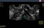 Aparelho de Ultrassom Ecocardiograma - FT422