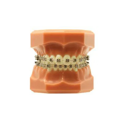 Integra Edgewise - N&F Ortho Dental