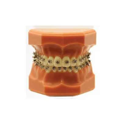 Synergy Bioprogressiva / Ricketts - N&F Ortho Dental