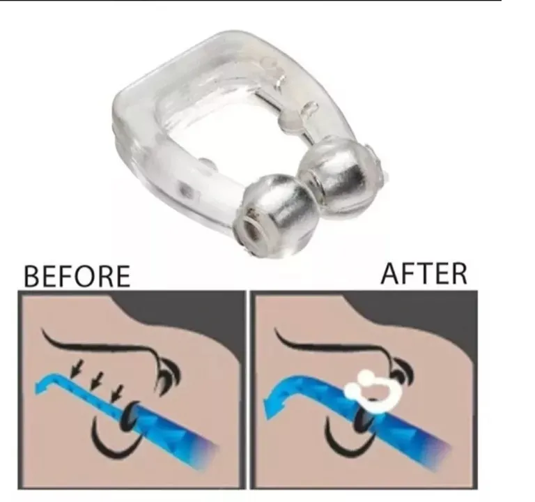 Kit 3 Clip Nasal Anti Ronco Magnético Com Imã Apneia Nariz