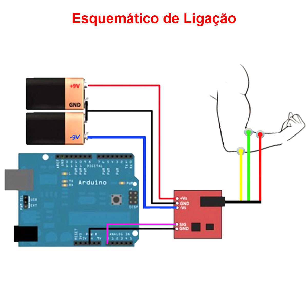 Sensor de Sinal Eletromiográfico EMG - Sensor de Sinal Muscular