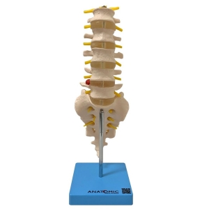 Coluna Vertebral Lombar - Anatomic TGD-0145-B