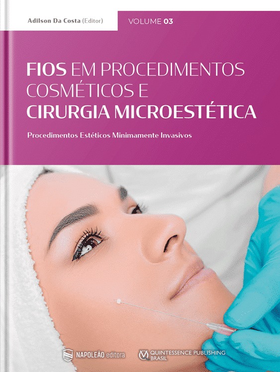 Fios em Procedimentos Cosméticos e Cirurgia Microestética  Procedimentos Estéticos Minimamente Invasivos Vol. 03