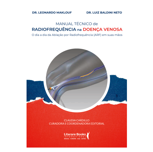 Manual técnico de radiofrequência na doença venosa: o dia a dia da Ablação por Radiofrequência (ARF) em suas mãos