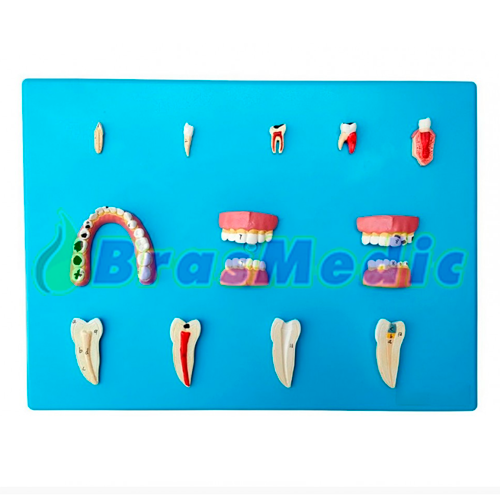 Patologia Dentária com 12 Peças Código:TZJ-0311-P
