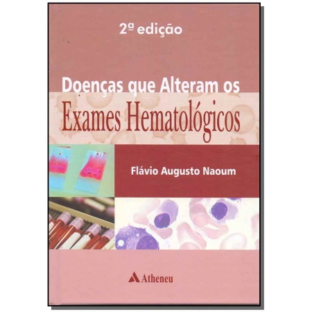 Doencas Que Alteram Exames Hematologicos-01ed/17
