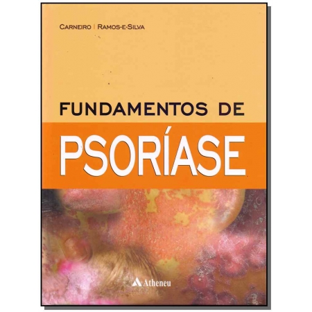 Fundamentos De Psoriase -  01Ed/17