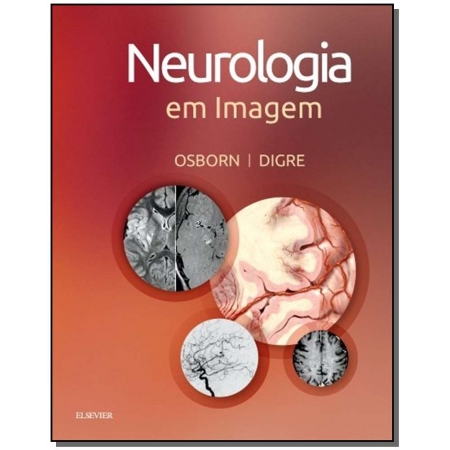Neurologia Em Imagem