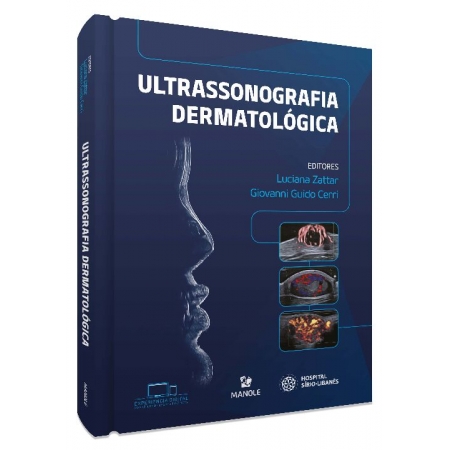 Ultrassonografia dermatológica