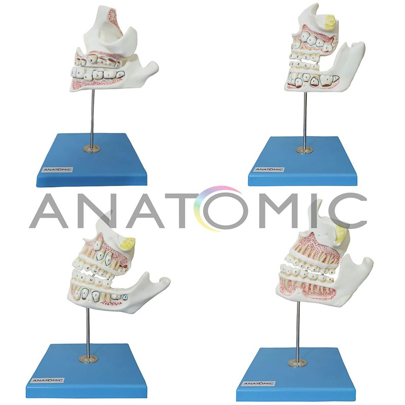 Desenvolvimento da Dentição com 4 Peças - ANATOMIC TZJ-0313-D