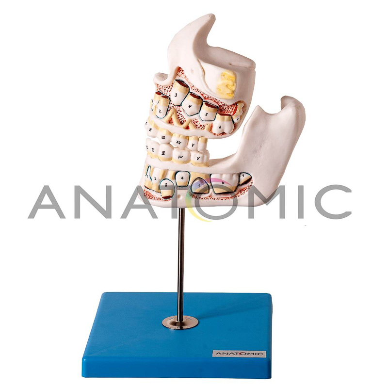 Desenvolvimento da Dentição com 4 Peças - ANATOMIC TZJ-0313-D