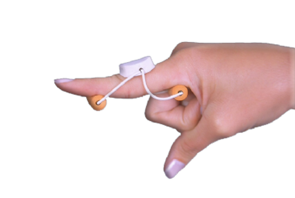 Splint tipo Gangorra para Extensão do Dedo (Mola Forte) - ORTOCENTER   OC 0331-0