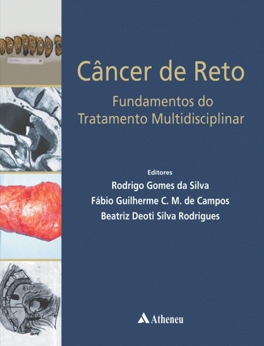 CANCER DE RETO - FUNDAMENTOS DO TRATAMENTO MULTIDISCIPLINAR